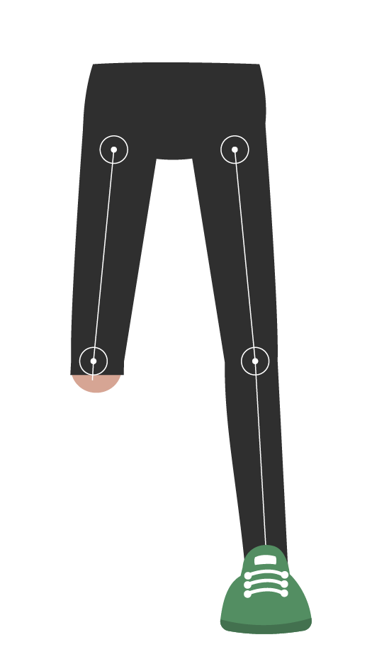 imagen frontal de brazo nivel amputación muñeca