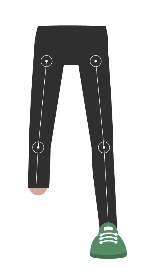 imagen frontal de brazo nivel amputación debajo del codo